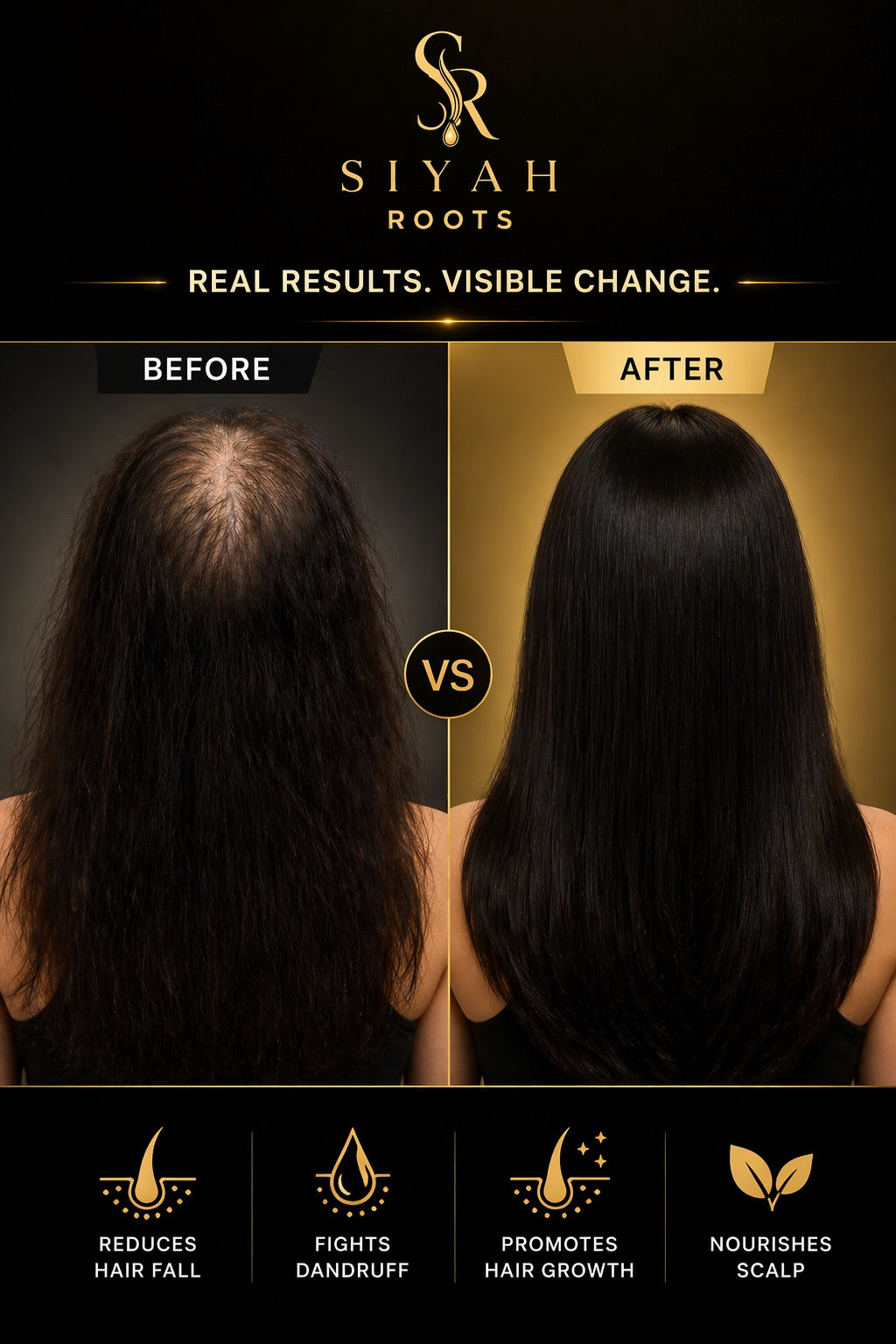 SIYAH Roots Organic Premium Hair Oil (150ml)