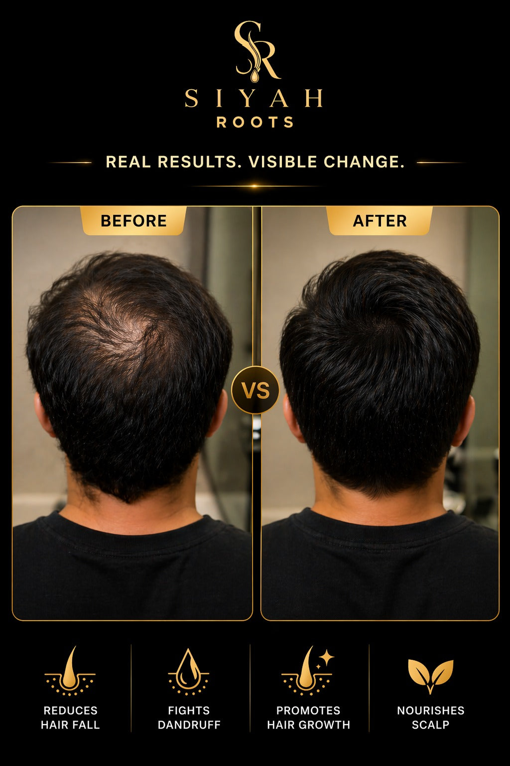 SIYAH Roots Organic Premium Hair Oil (150ml)